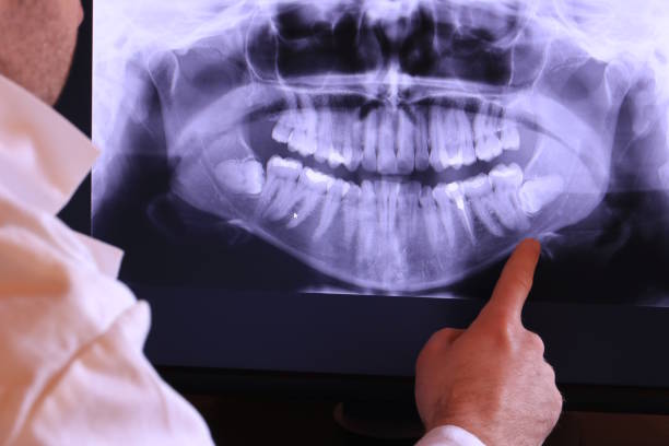 Best Emergency Treatment for Toothache in New Vienna, OH